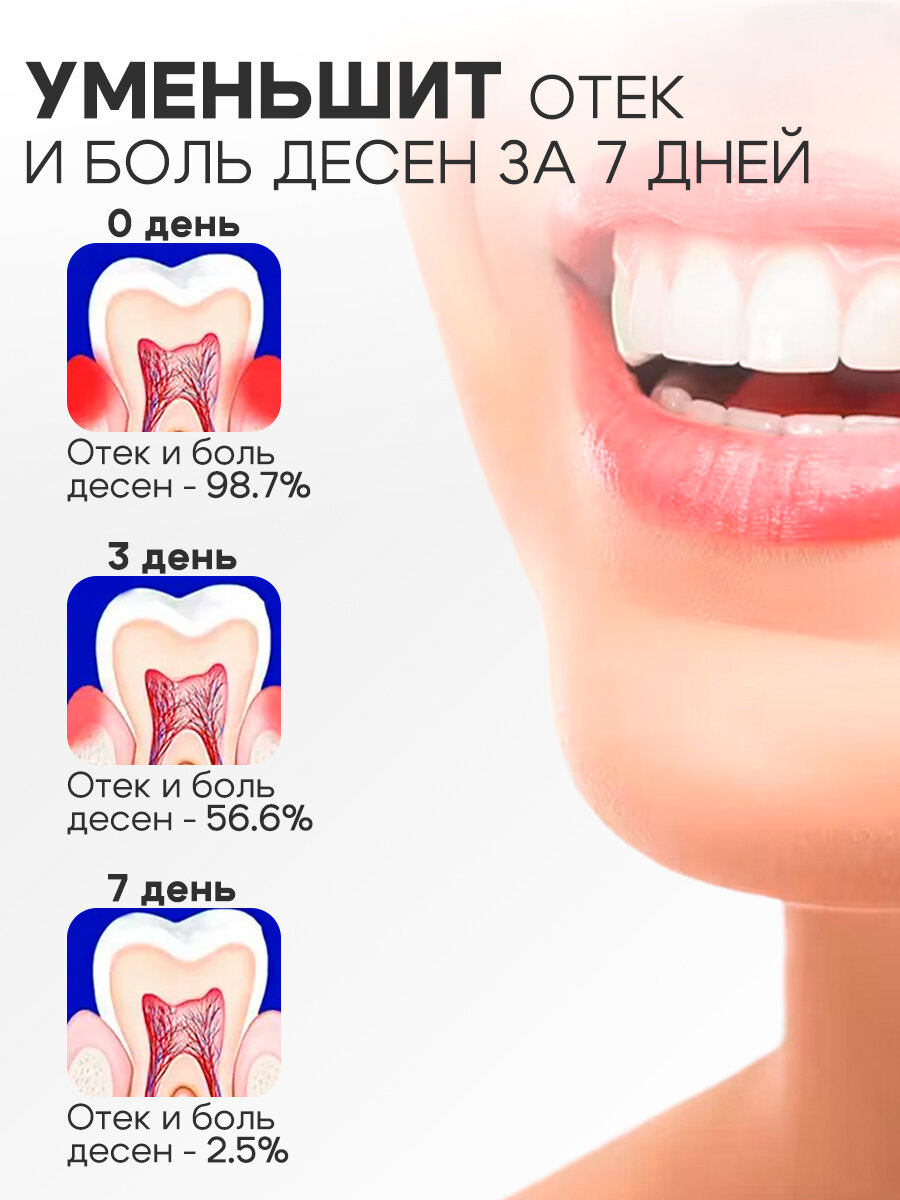 Стоматологические Анестетики И Обезболивающие Спрей от зубной боли, быстрое облегчение боли, эффективное уменьшение отека / Ротовой спрей