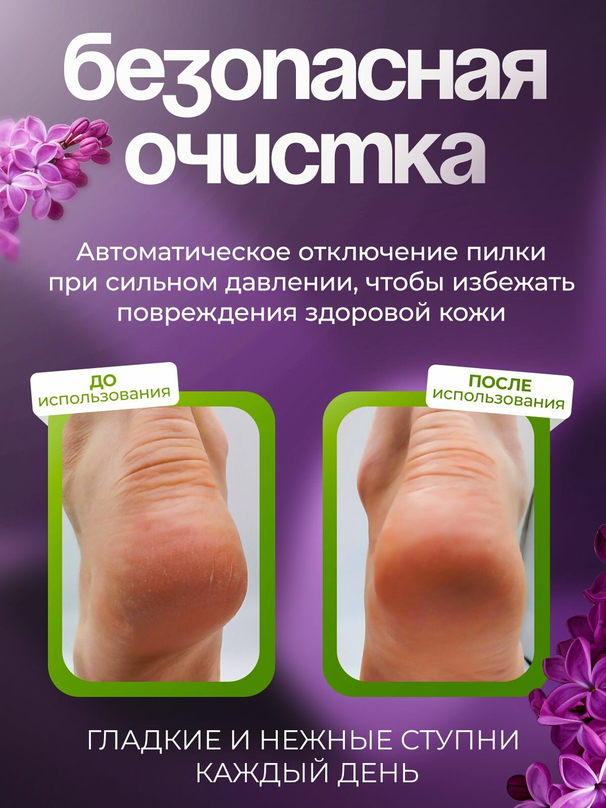 Изображение Аппарат для педикюра GETLUX "Нежные пяточки", для пяток, с аккумулятором, 3 насадки, белый