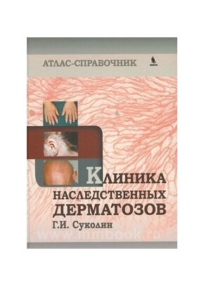 Клиника наследственных дерматозов. Атлас-справочник - фото №3