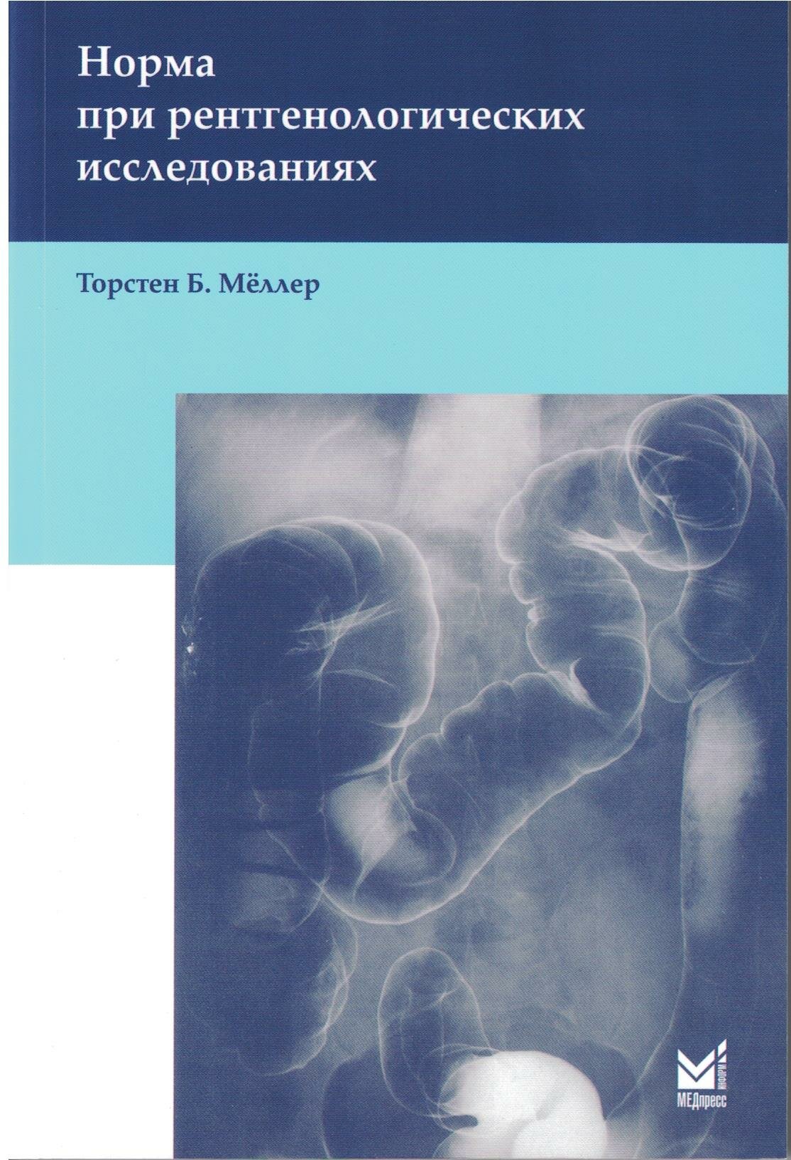 Норма при рентгенологических исследованиях / 3-е изд. - фото №1