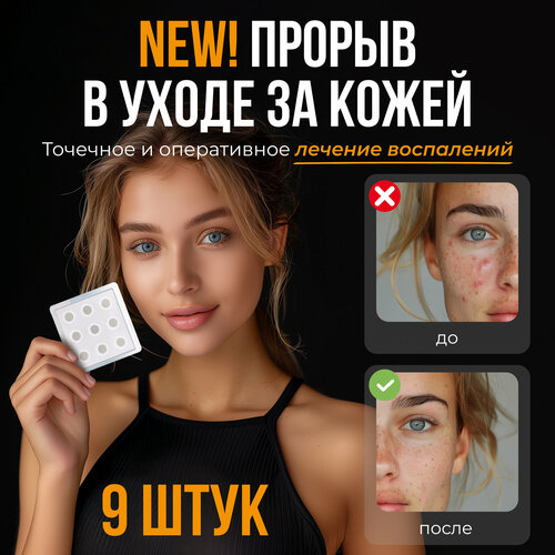 Патчи гидроколлоидные с микроиглами от прыщей Honey Care 9 штук 550₽