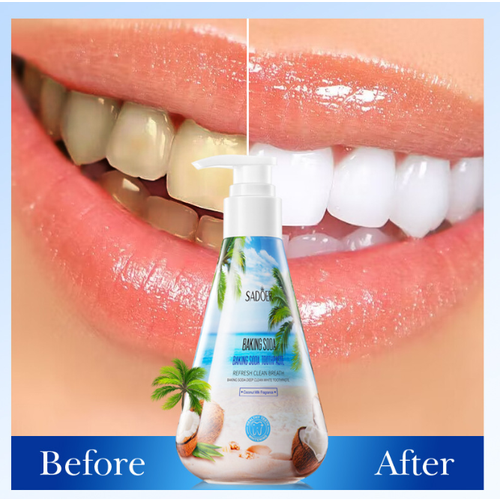 Гелевая отбеливающая зубная паста SADOER со вкусом кокоса защита от образования зубного камня 485₽