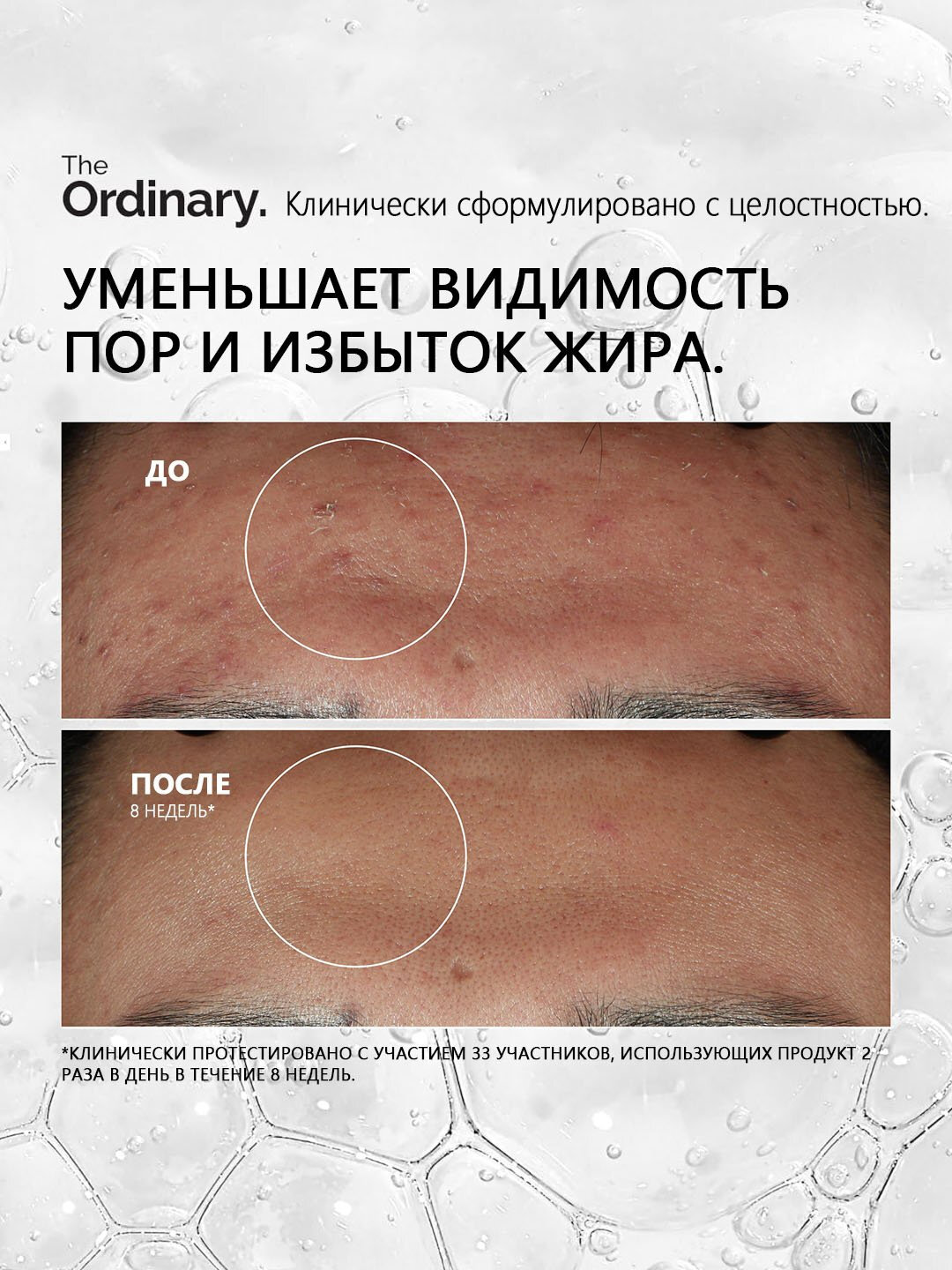 Сыворотка для лица The Ordinary, с ниацинамидом, цинком, 30мл — фото 1