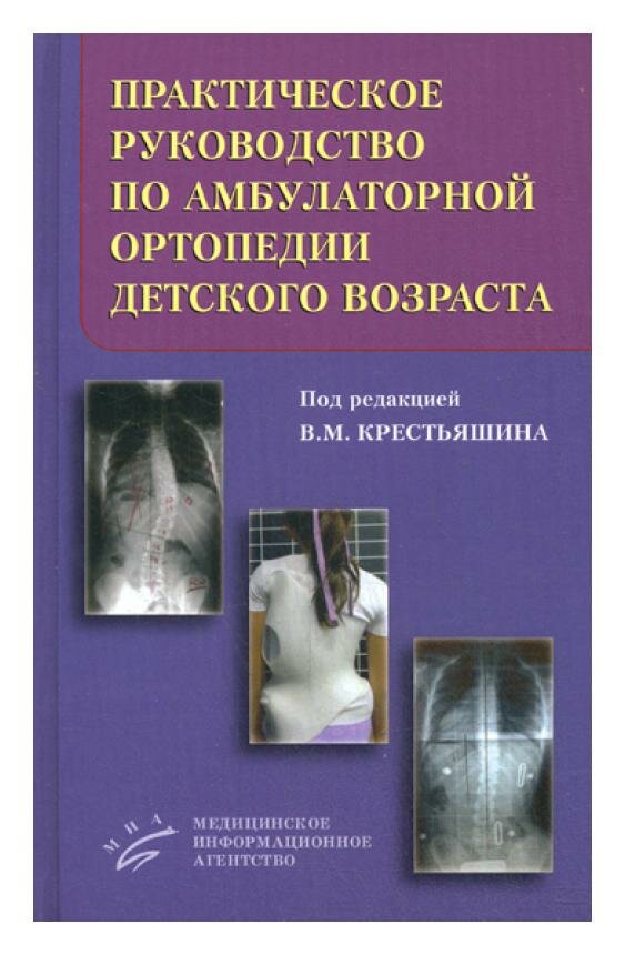 Практическое руководство по амбулаторной ортопедии детского возраста. МИА