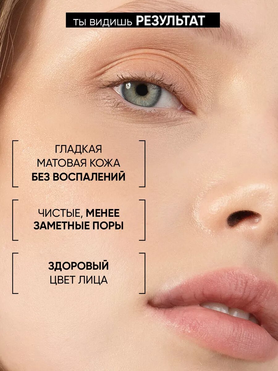 Изображение BEAUTIFIC Крем-маска для сужения пор ACNE AWAY, от черных точек, прыщей и акне, 75 мл