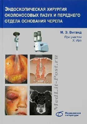 Эндоскопическая хирургия околоносовых пазух и переднего отдела основания черепа