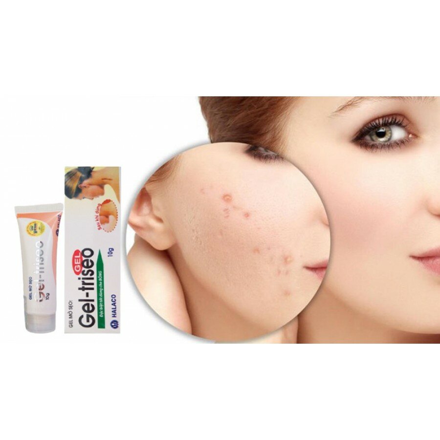 Картинки Гель от рубцов, шрамов и растяжек с экстрактом лука Gel - Triseo, 10 гр