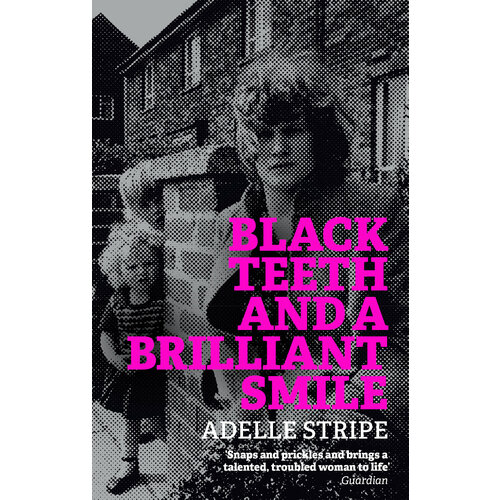 Black Teeth and a Brilliant Smile | Stripe Adelle