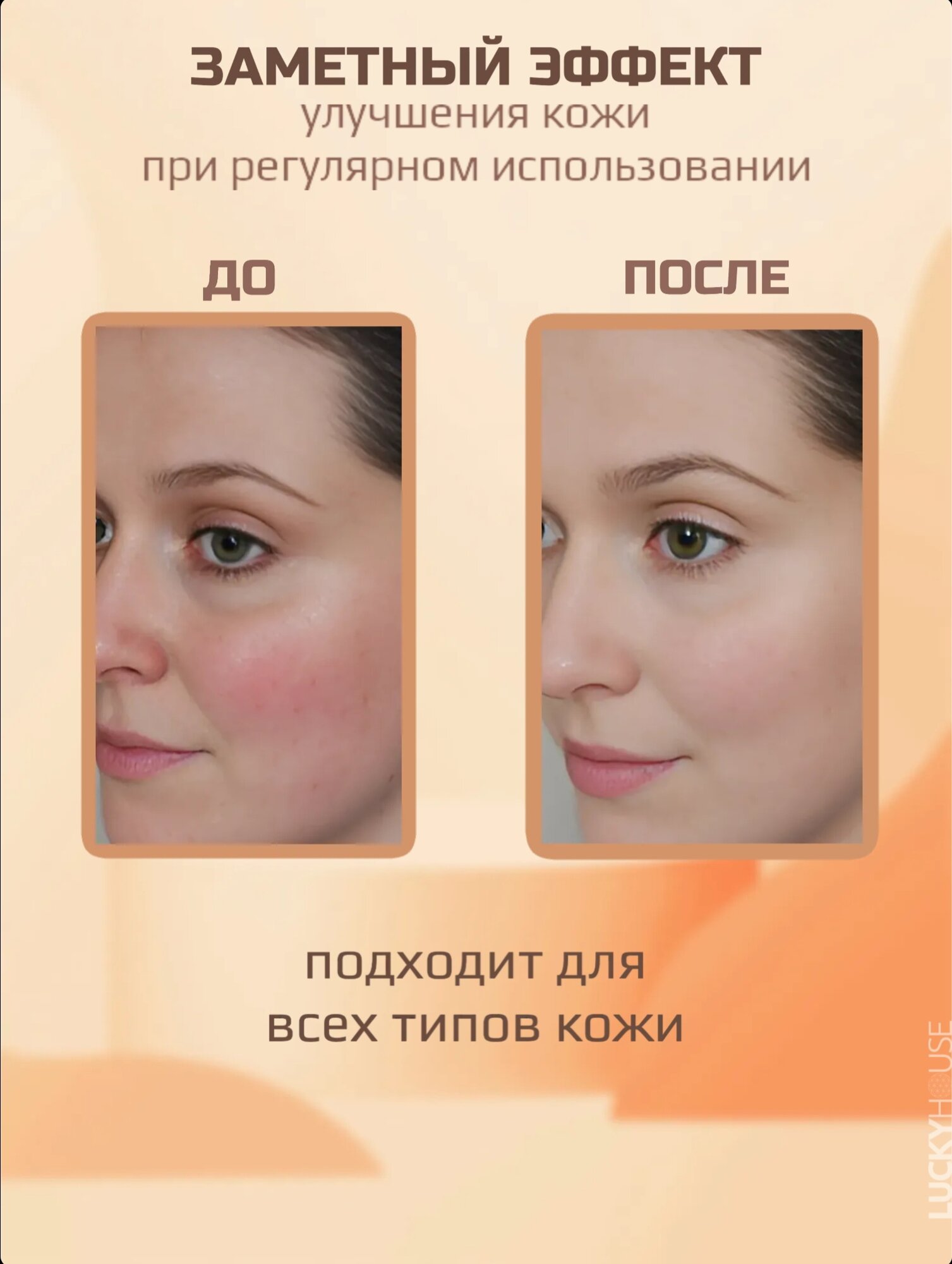 Лосьоны Для Лица Holy Land Лосьон GINSENG & CARROT Lotion