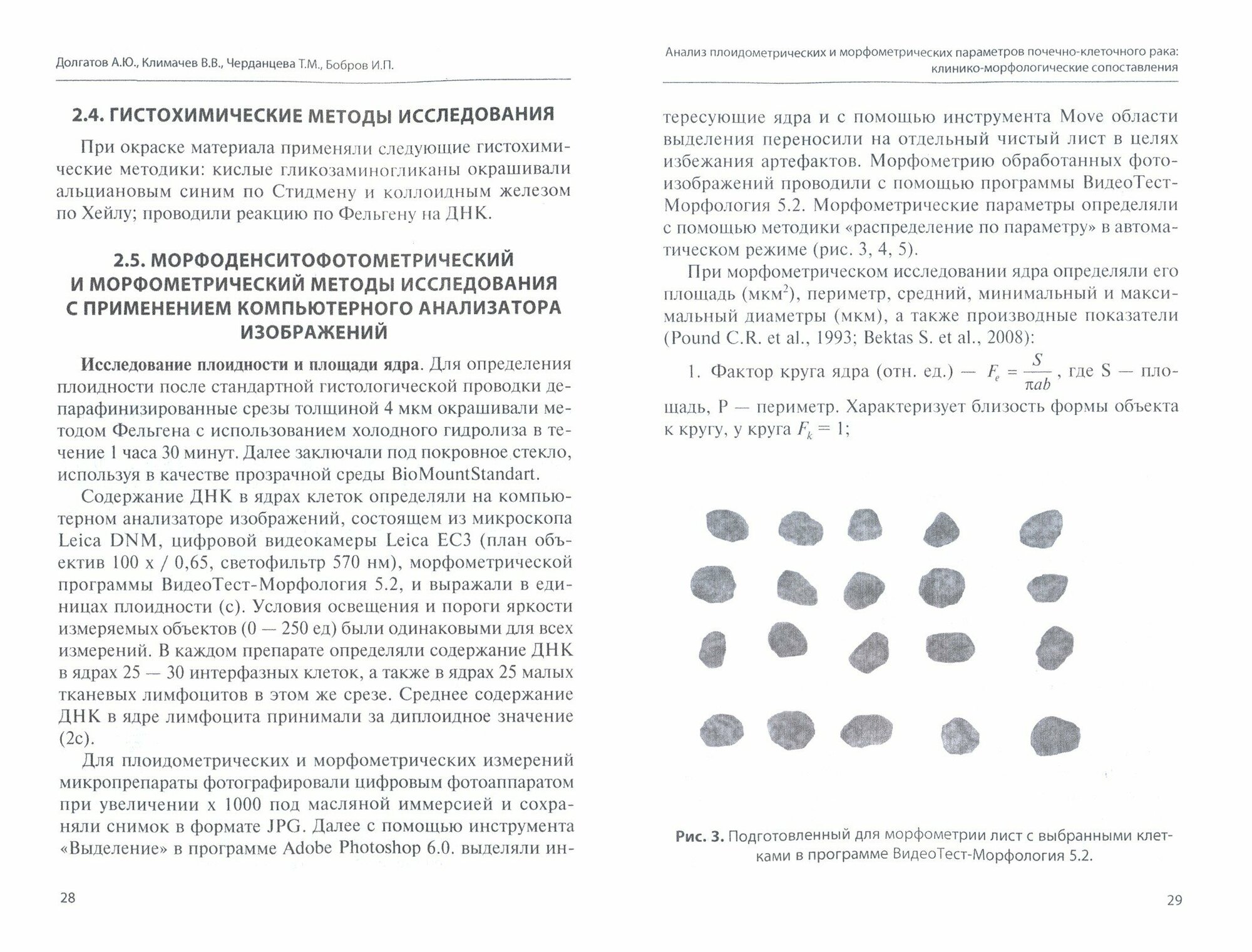 Анализ плоидометрических и морфометрических параметров почечно-клеточного рака. Монография - фото №4