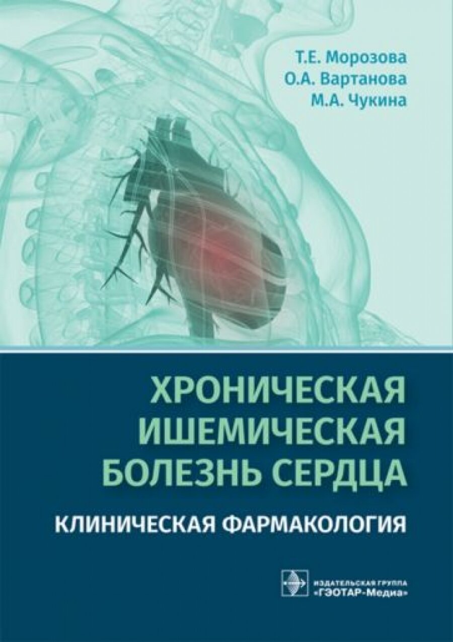 Хроническая ишемическая болезнь сердца. Клиническая фармакология - фото №1