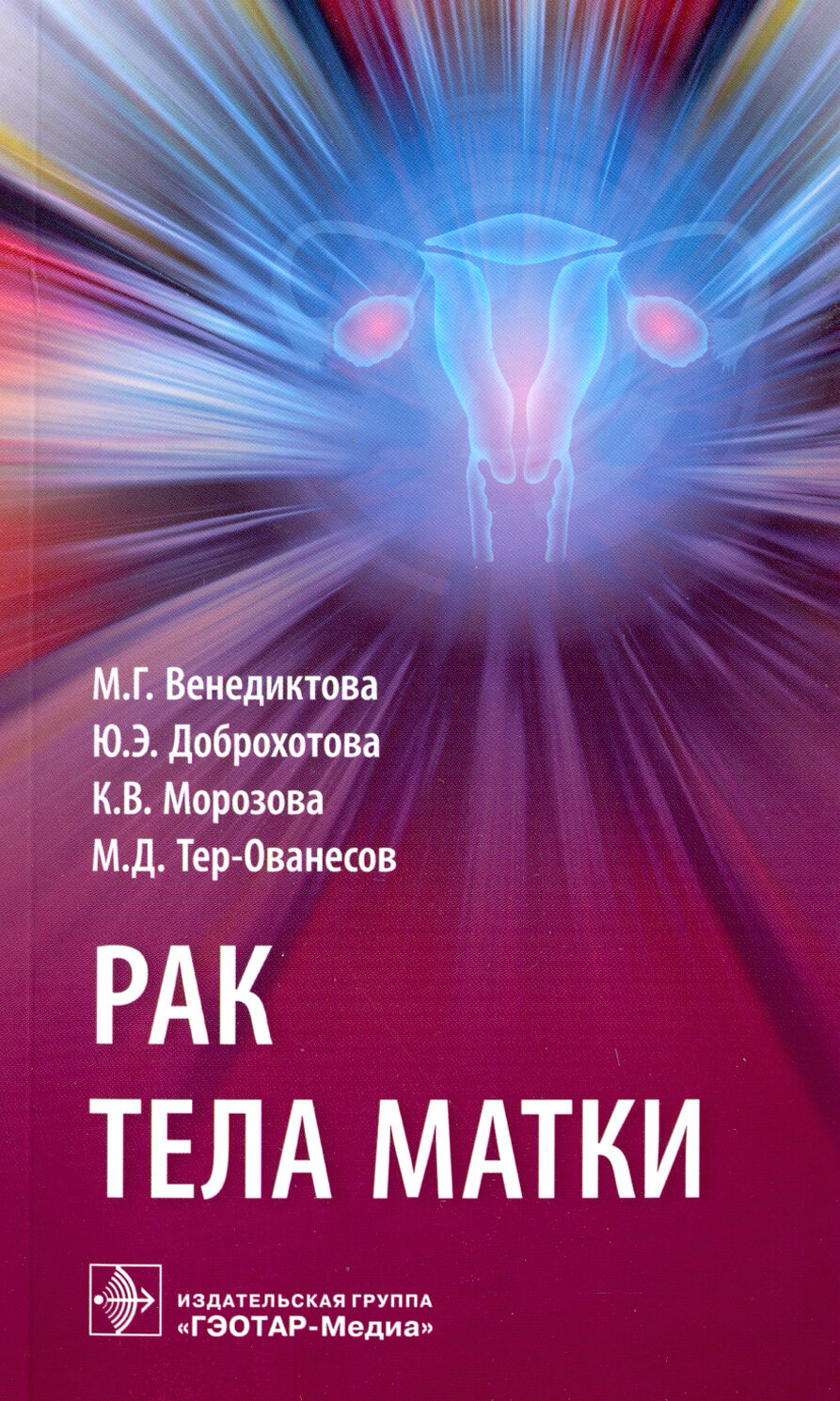 Рак тела матки