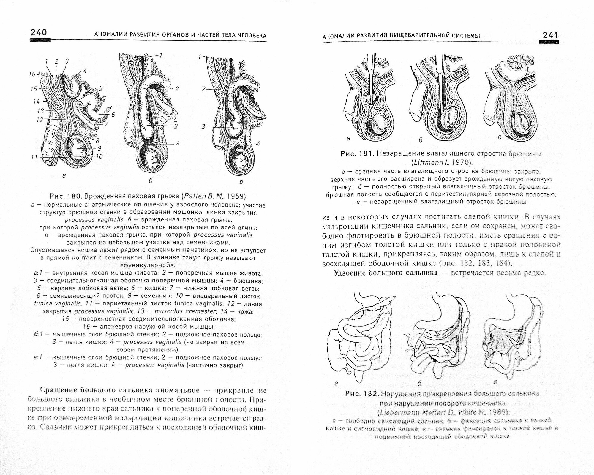 Аномалии развития органов и частей тела человека. Учебное пособие - фото №4