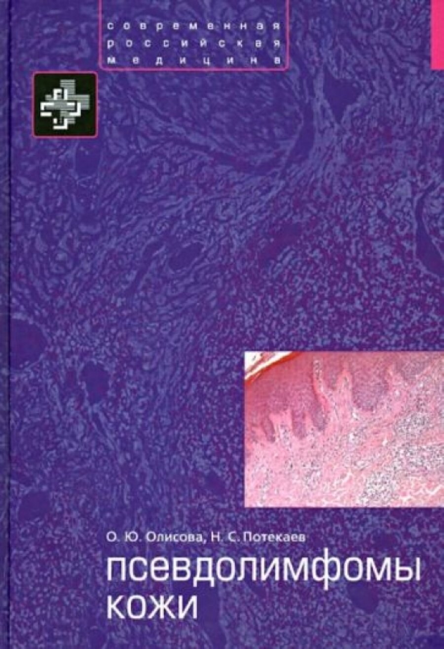 Псевдолимфомы кожи (и другие, , Потекаев, Николай Сергеевич, Олисова, Ольга Юрьевна) - фото №2