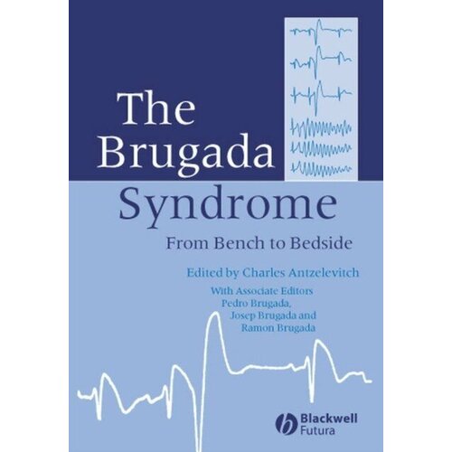 Antzelevitch "The Brugada Syndrome.2005"