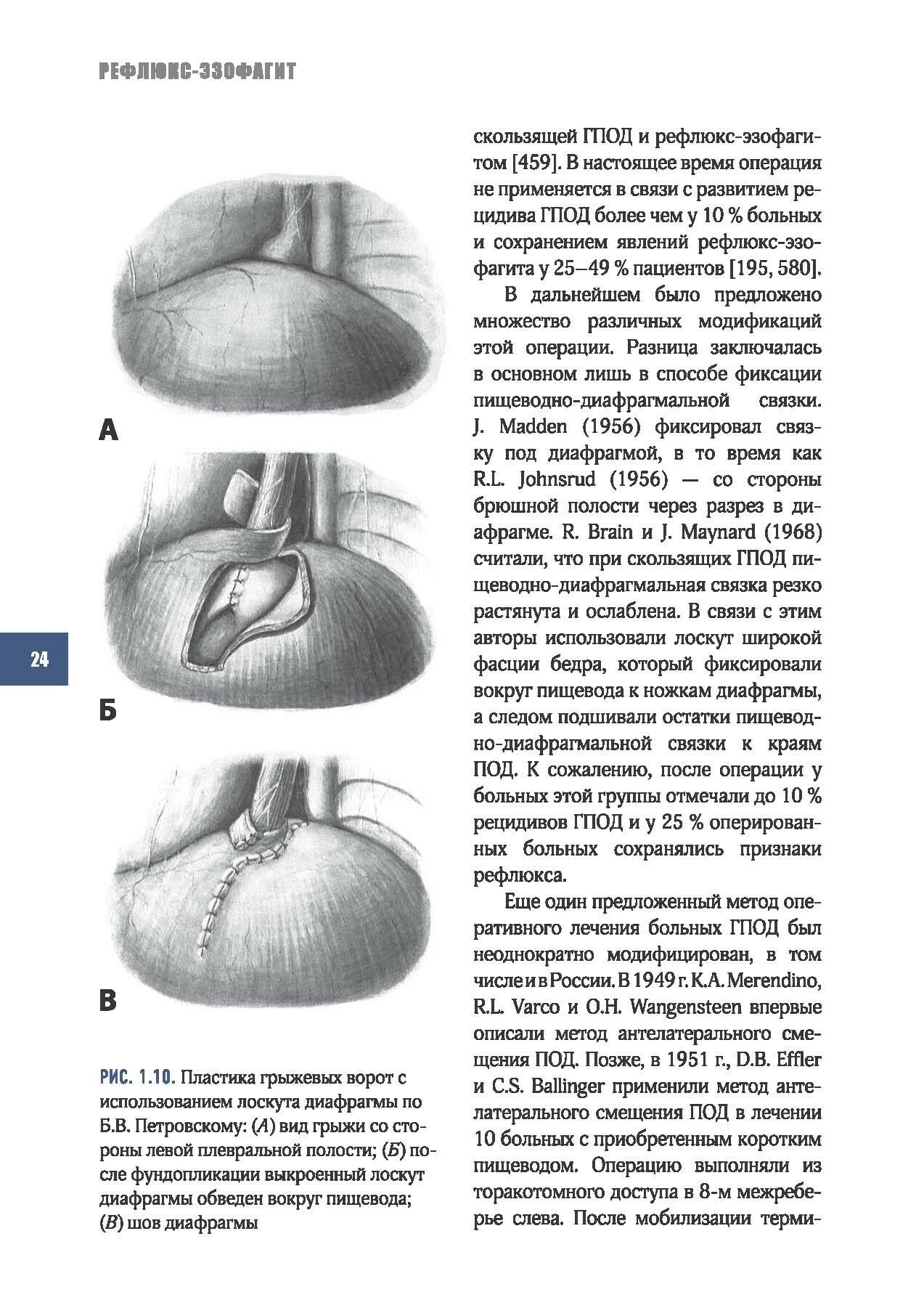 Рефлюкс-эзофагит (Черноусов Александр Федорович, Хоробрых Татьяна Витальевна, Ветшев Федор Петрович) - фото №14