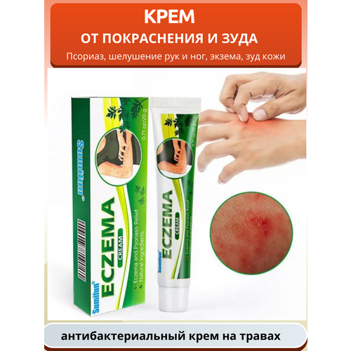Антибактериальный крем для лечения псориаза и экземы 424₽