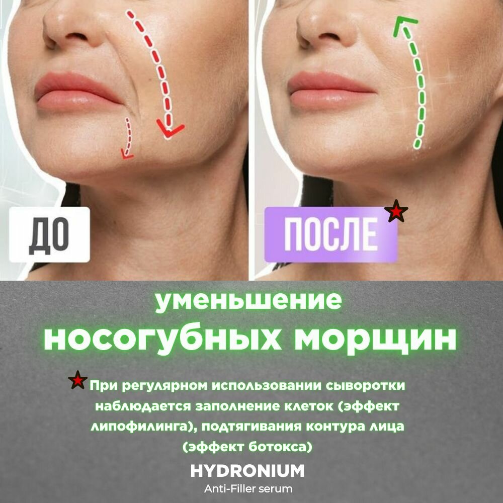 Картинки Сыворотка для носогубных складок HYDRONIUM Anti-filler