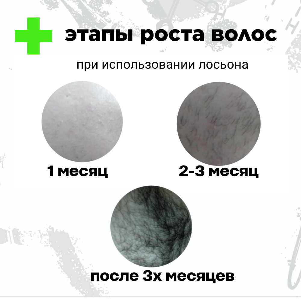 Лосьон MINOXDL 15% для роста волос и бороды против выпадения 60 мл — фото 1