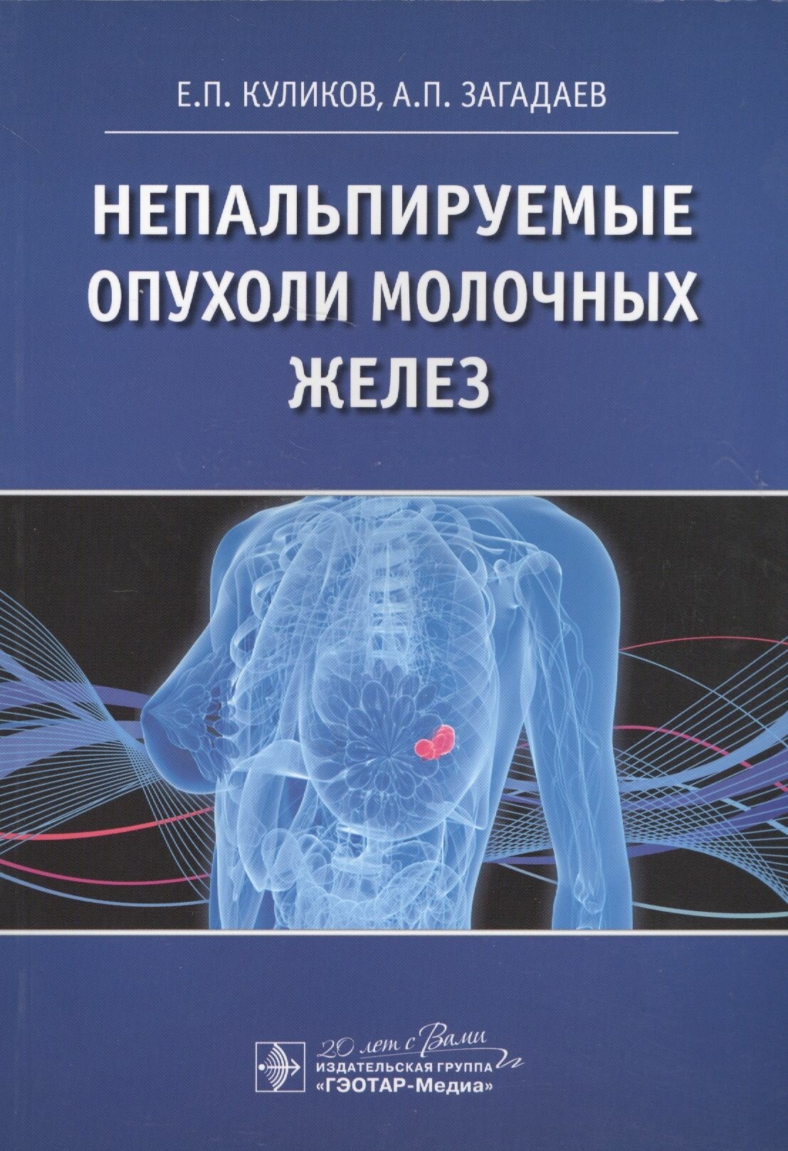 Непальпируемые опухоли молочных желез