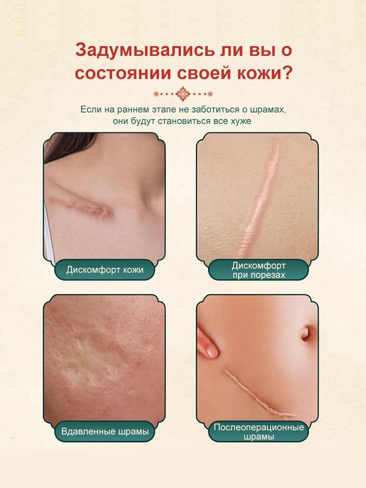 Изображение Медицинский крем от шрамов 30 гр восстановление кожи, шрамов, быстрая починка рубцов, растяжек для беременных и пигментации