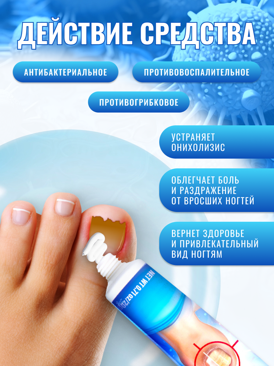 Средство от грибка ногтей на ногах Sumifun / Крем для борьбы с несовершенствами / Мазь для ухода за ногами против онихолизиса — фото 1