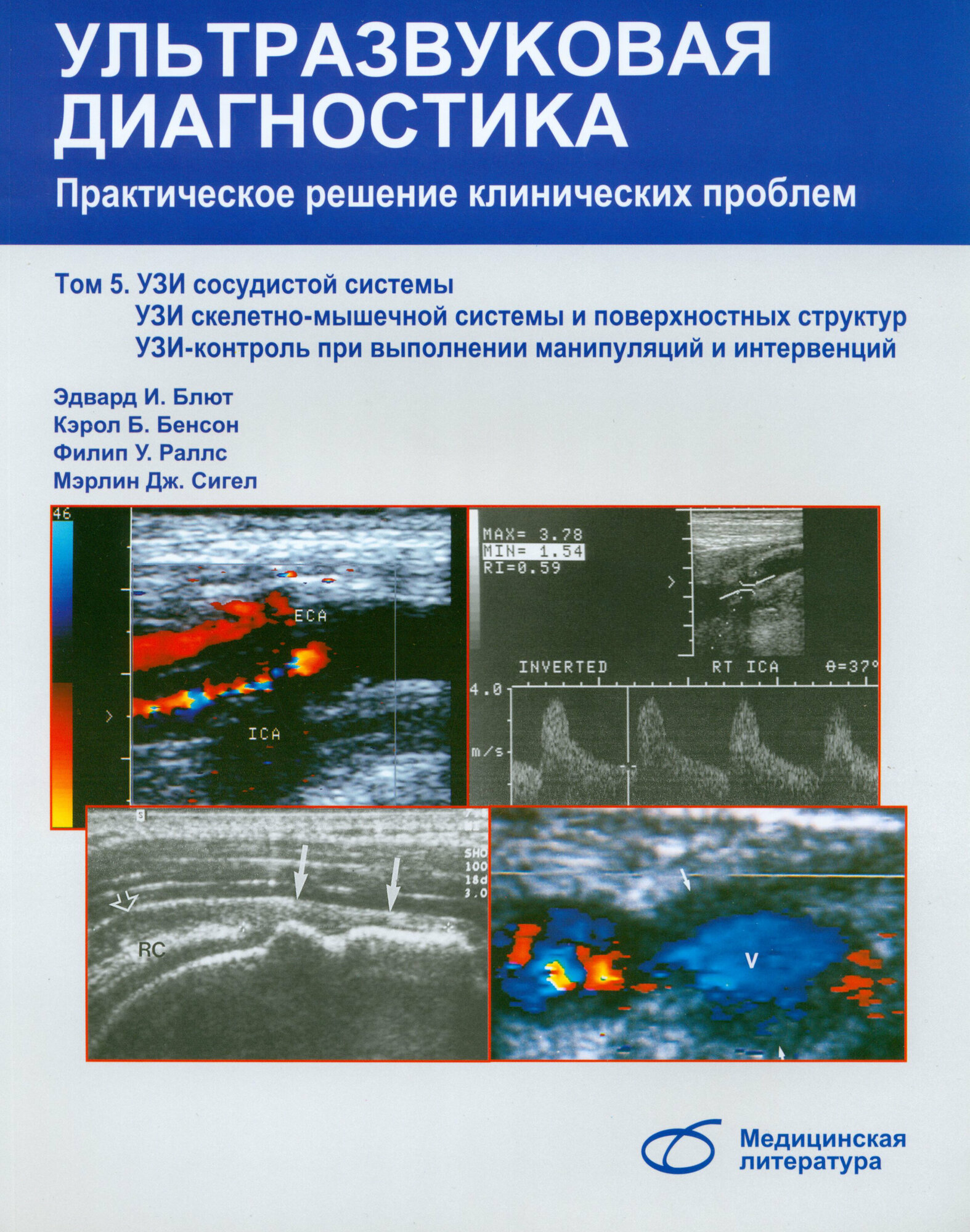 Ультразвуковая диагностика. Практическое решение клинических проблем. Том 5 | Блют Эдвард И.