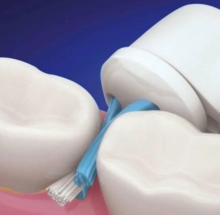 Насадка Braun Oral-B Interspace для имплантов, брекетов и протезов (1шт)