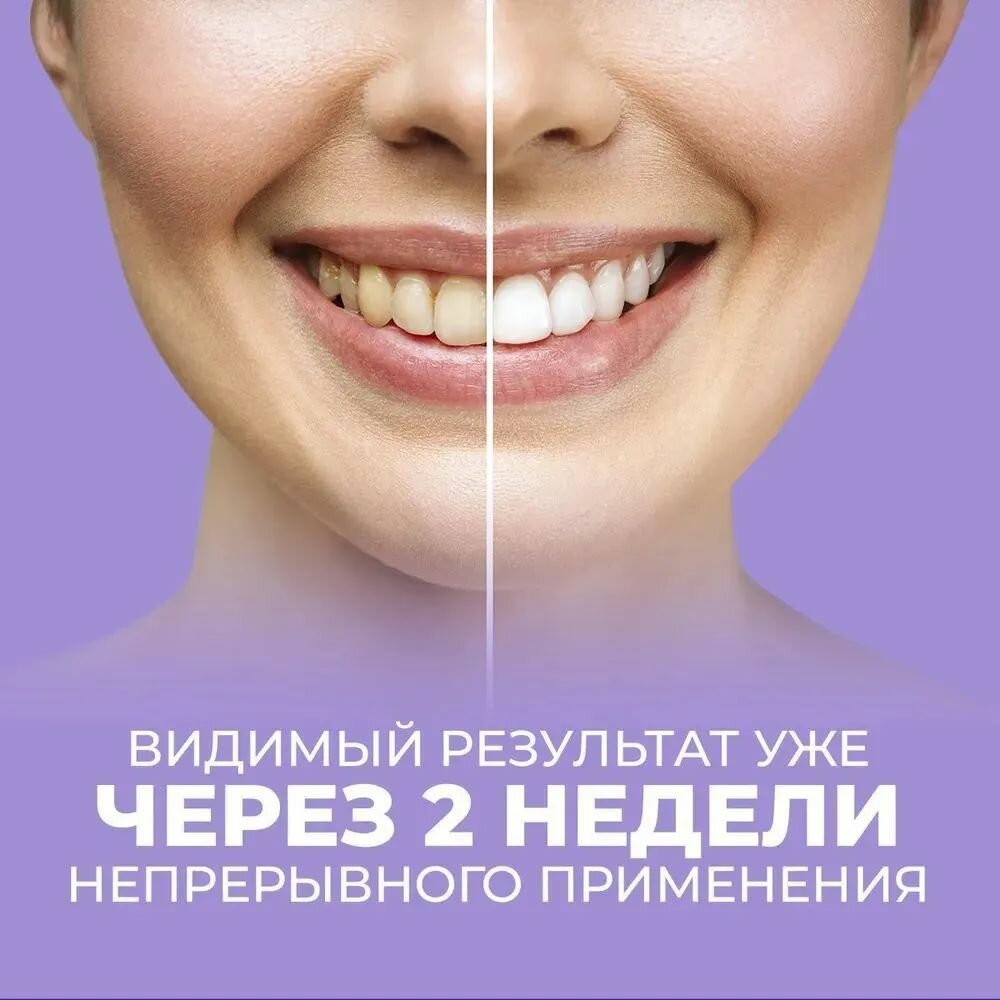 Системы Отбеливания Зубов Xiaomi Зубная паста V34 SMILEKIT отбеливающая с дозатором, фиолетовое отбеливание зубов, удаление пятен на зубах, 30 мл