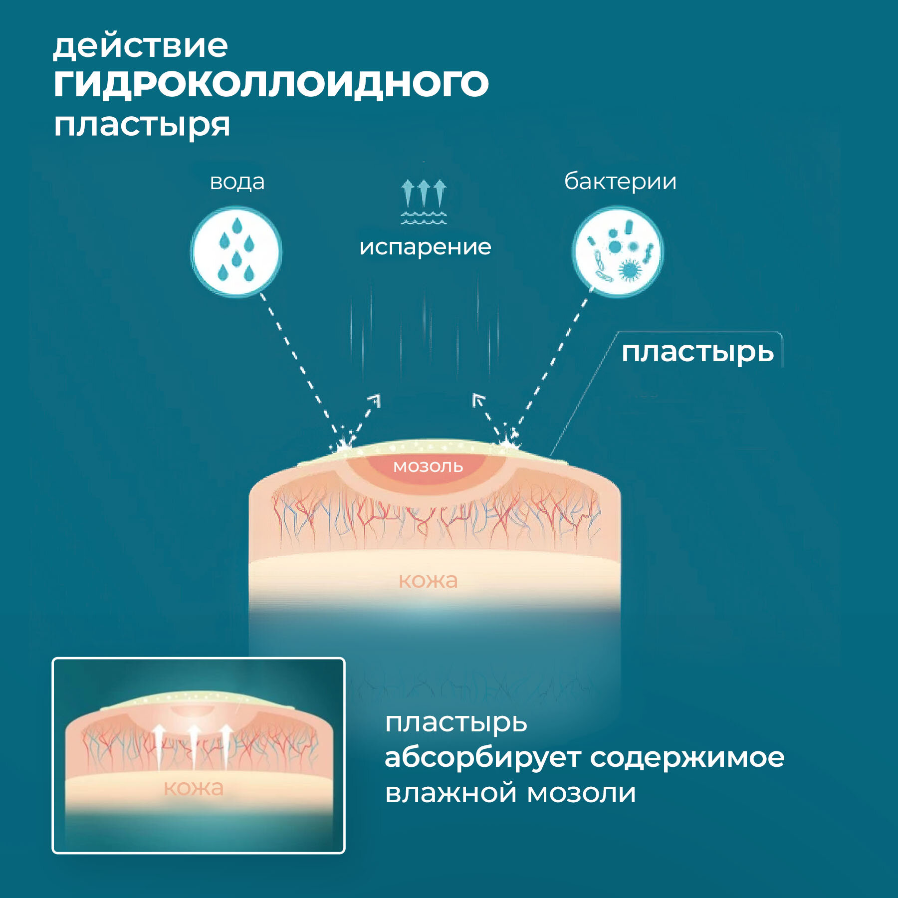 Компид Пластырь от сухих враст.мозолей между пальцами ног 10 шт ДЖОНСОН И ДЖОНСОН - фото №5