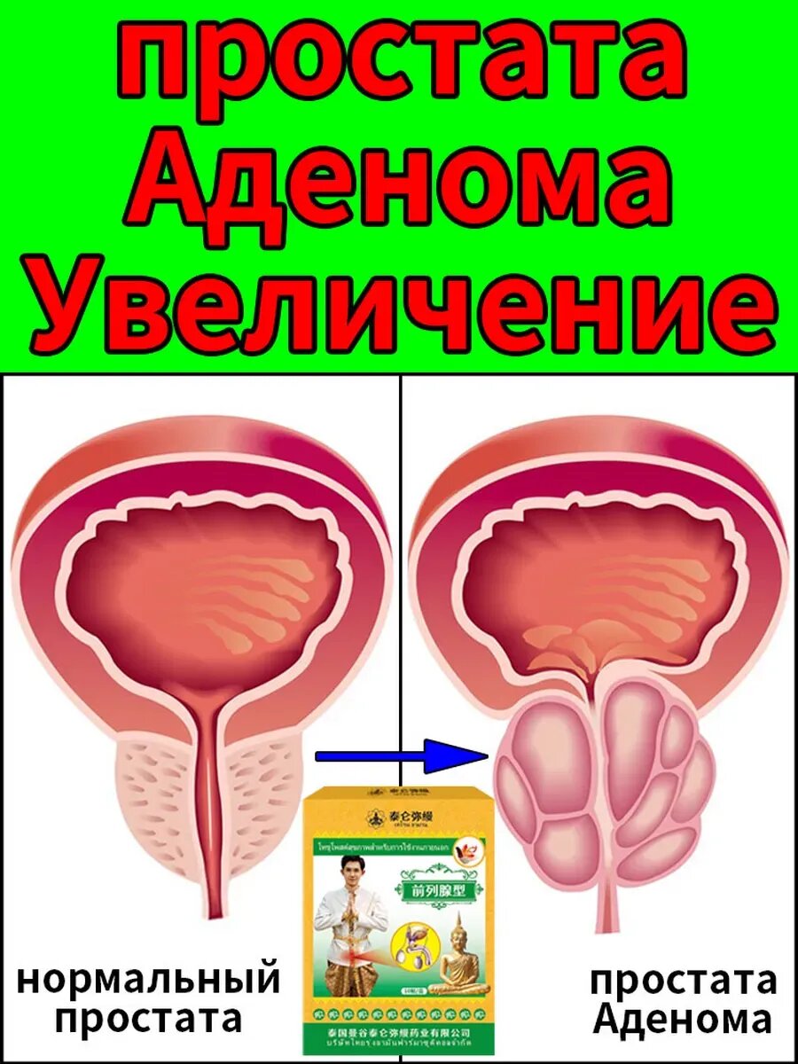 Китай пластырь для простаты боли и частых мочеиспусканий