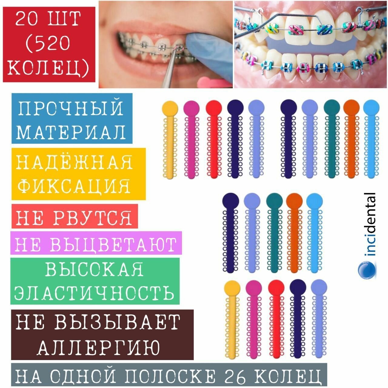 Эластичные ортодонтические Лигатуры Inci LIGATURE TIES // Лигатуры для брекетов 20 шт. ( модуль 520 колец) , цветные . Инсидентал , Incidental .
