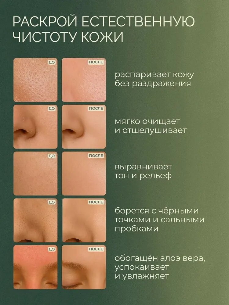 Гель холодного распаривания для ультразвуковой чистки лица, для всех типов кожи — фото 1