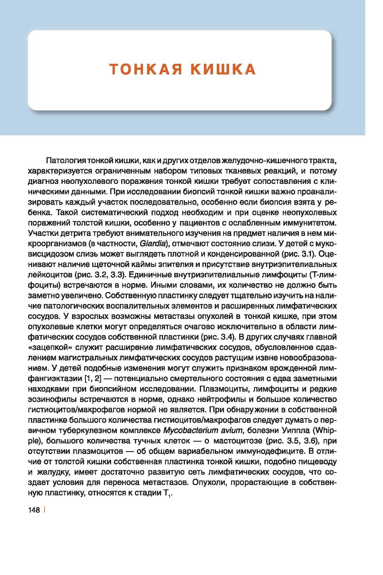 Интерпретация биопсий желудочно-кишечного тракта. Том 1. Неопухолевые болезни - фото №14