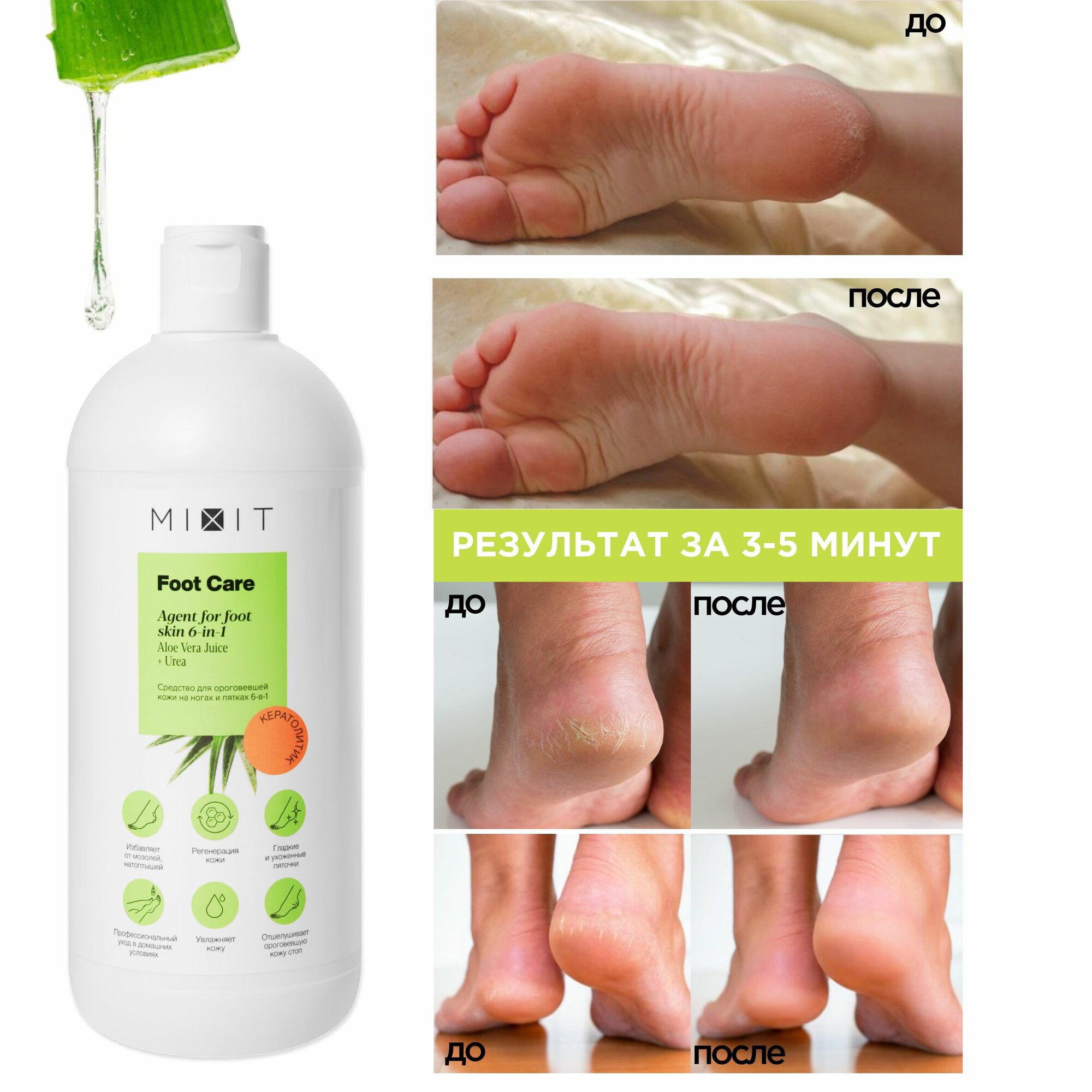 MIXIT Увлажняющий кератолитик для пяток против натоптышей, мозолей FOOT CARE, 500 мл