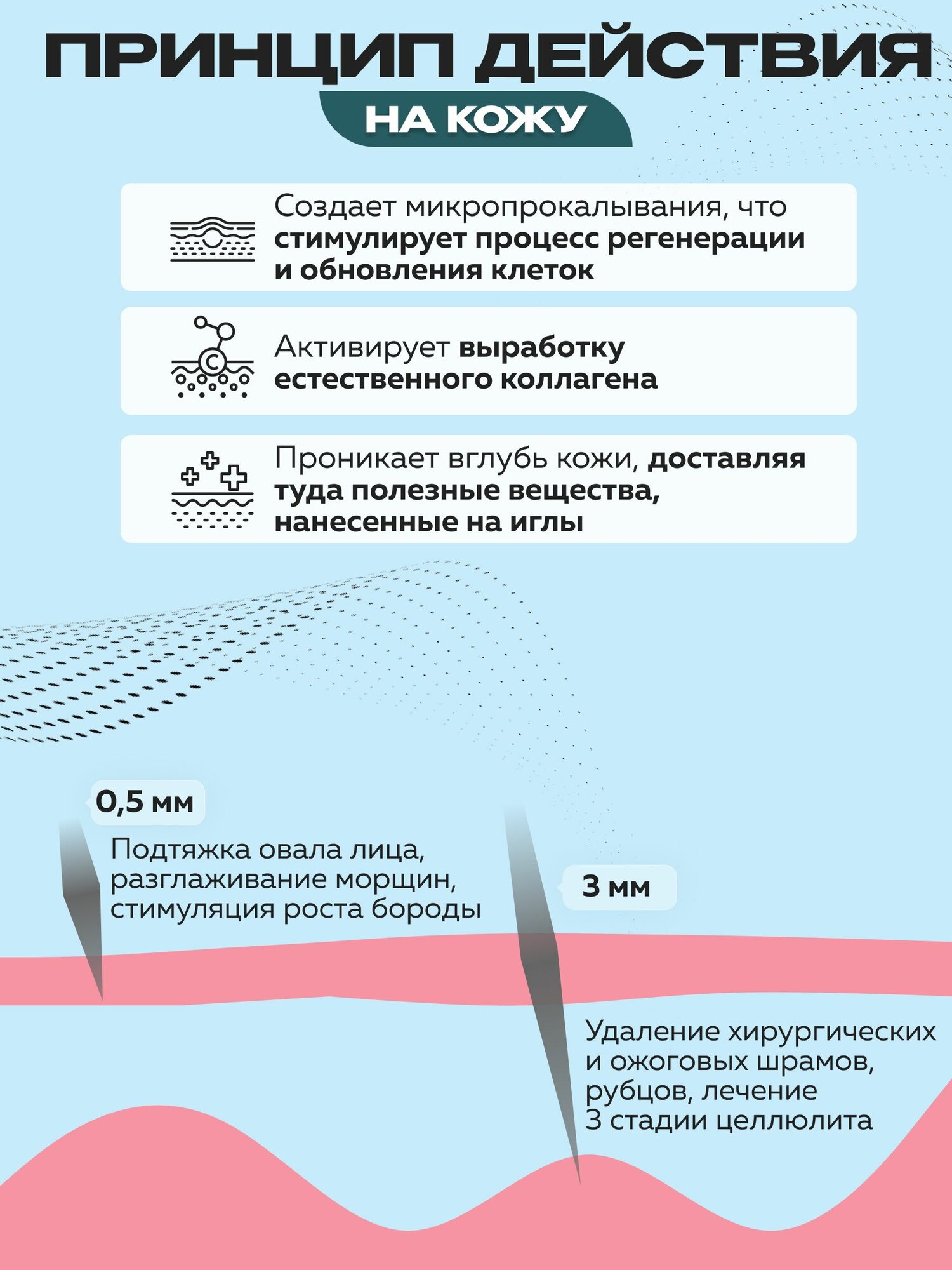 Массажный роллер UHOOMA Type A N1, 1200 стальных игл, длина игл 3 мм — фото 1