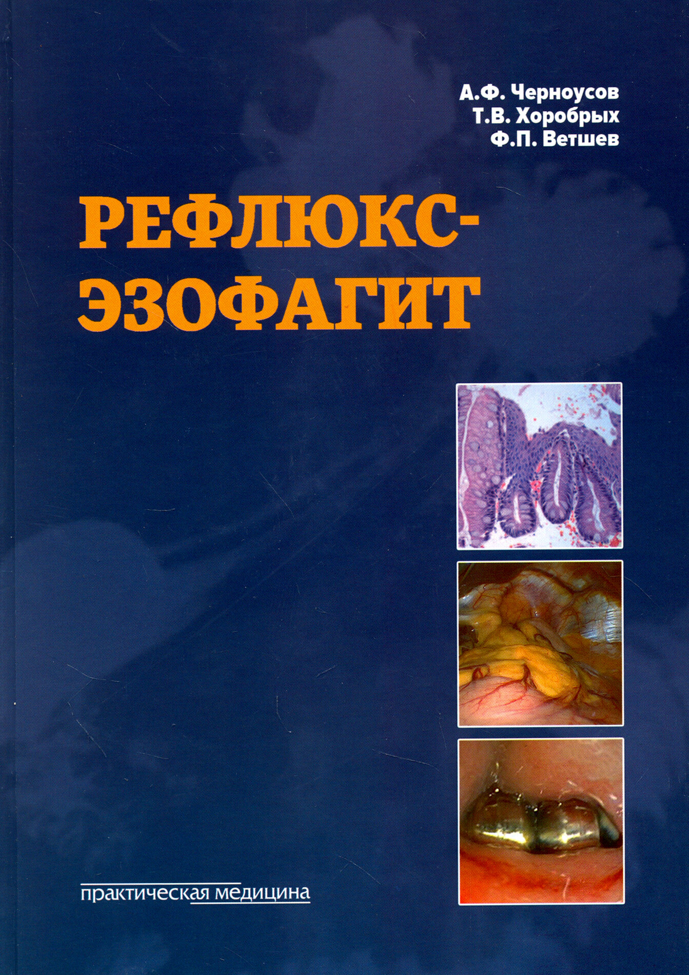 Рефлюкс-эзофагит (Черноусов Александр Федорович, Хоробрых Татьяна Витальевна, Ветшев Федор Петрович) - фото №13