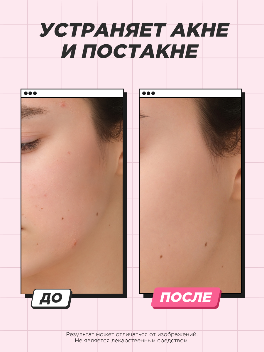 Картинки SENTENSLAB /Сыворотка для лица с гликолевой кислотой ниацинамидом против прыщей акне угрей для проблемной кожи