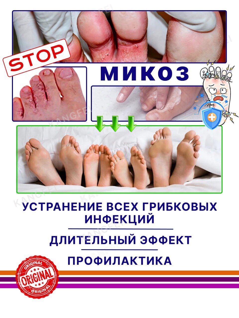 Противогрибковые Препараты Для Ногтей Набор от грибка на руках и ногах, от микозов кожи, масло+крем, антибактериальный эффект