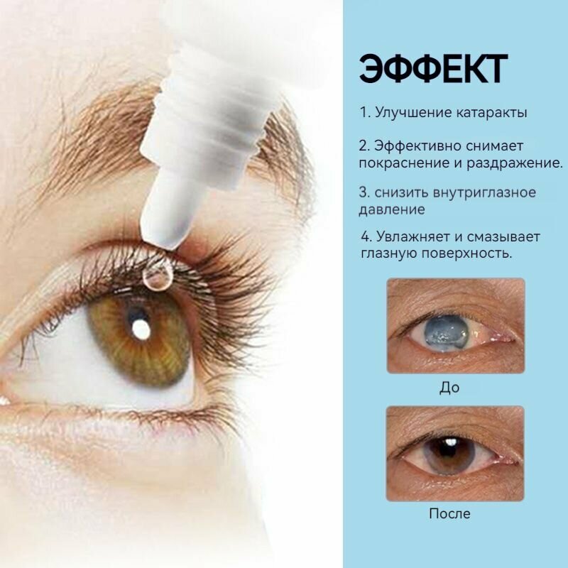 Картинки Испанские лютеиновые глазные капли используются при катаракте и глаукоме для устранения дискомфорта в глазах, ухудшения зрения, покраснения, увлажнения и очищения, 10 мл
