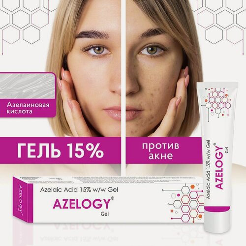 Изображение товара Гель Elegant Cosmed Стоп Акне азелоджи, азелаиновая кислота, 15%, 30г,
