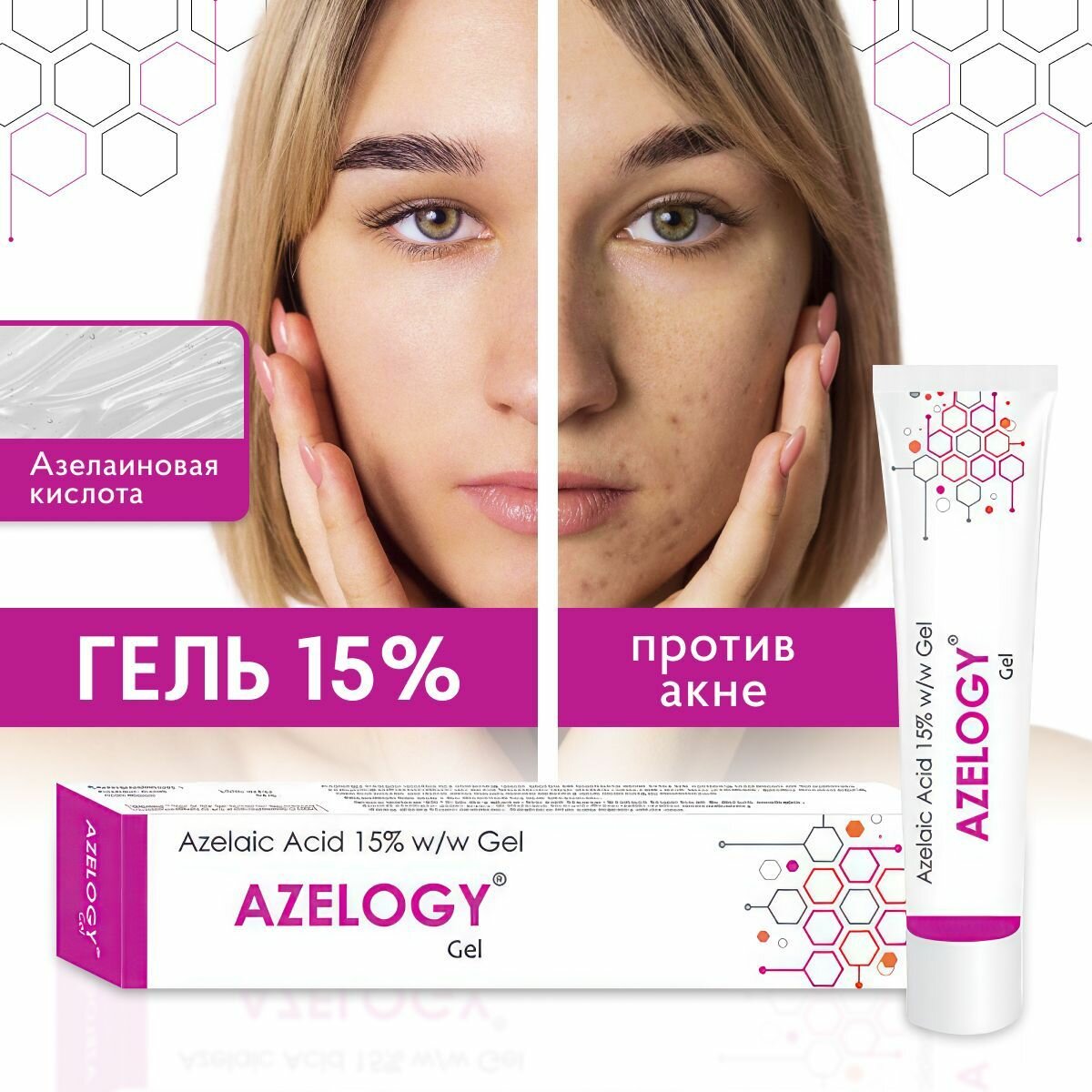 Гель Elegant Cosmed азелоджи, от акне, с азелаиновой кислотой, 15%, для всех типов, 30мл