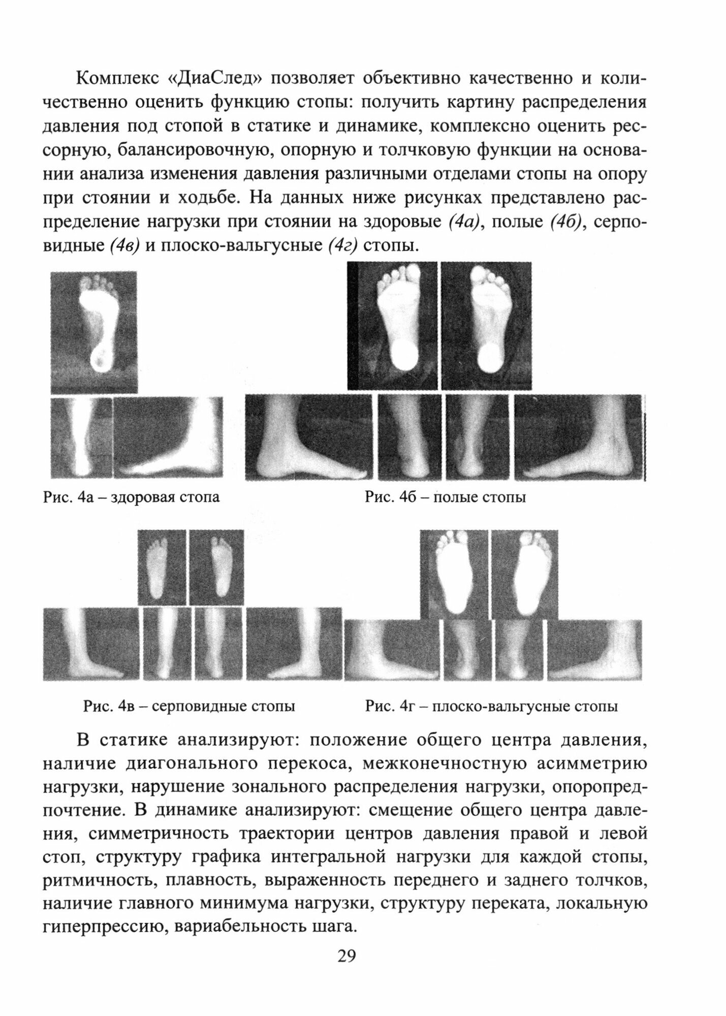 Комплект из 4 плакатов. Профилактика плоскостопия у детей. ФГОС до