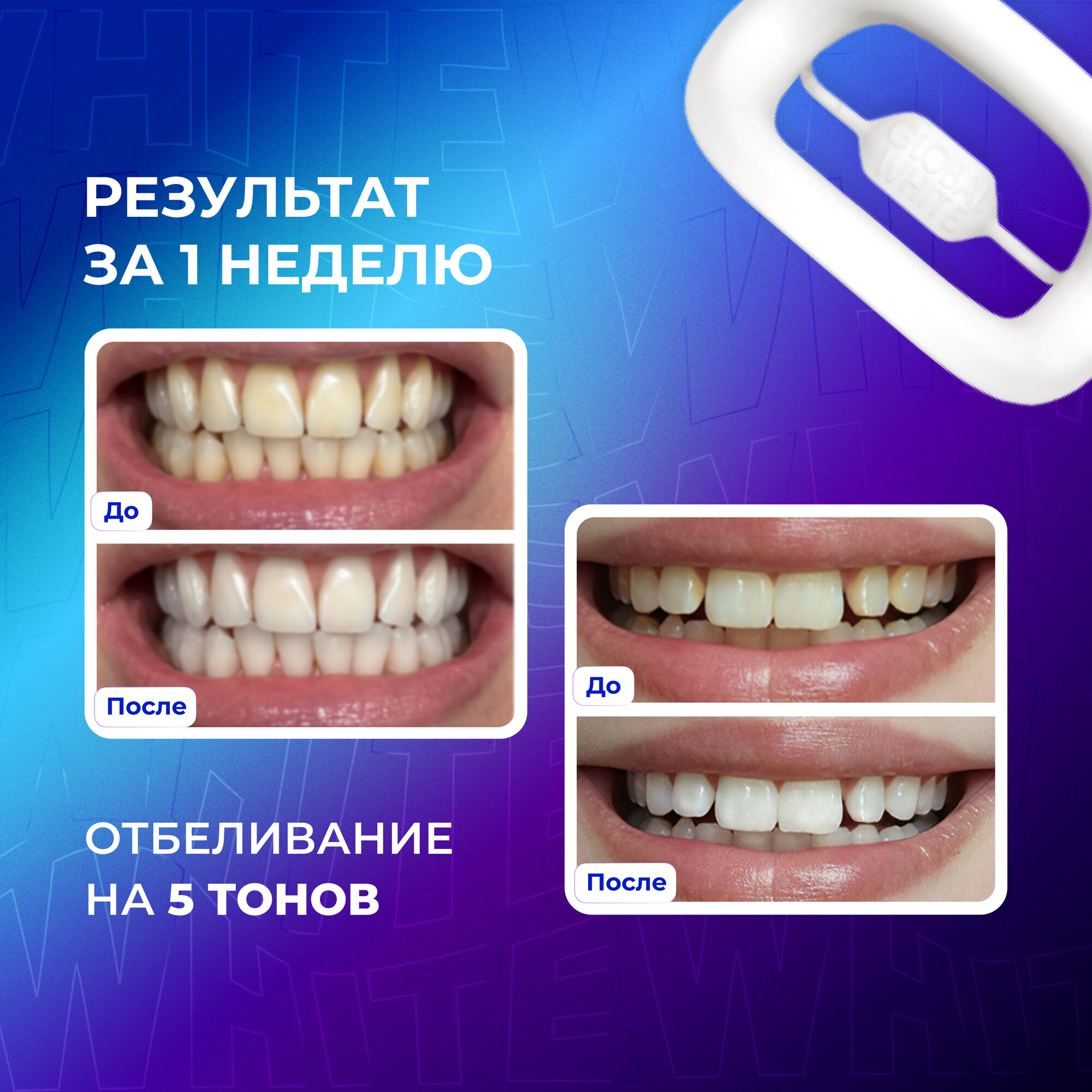 Система для отбеливания зубов GLOBAL WHITE / Whitening System