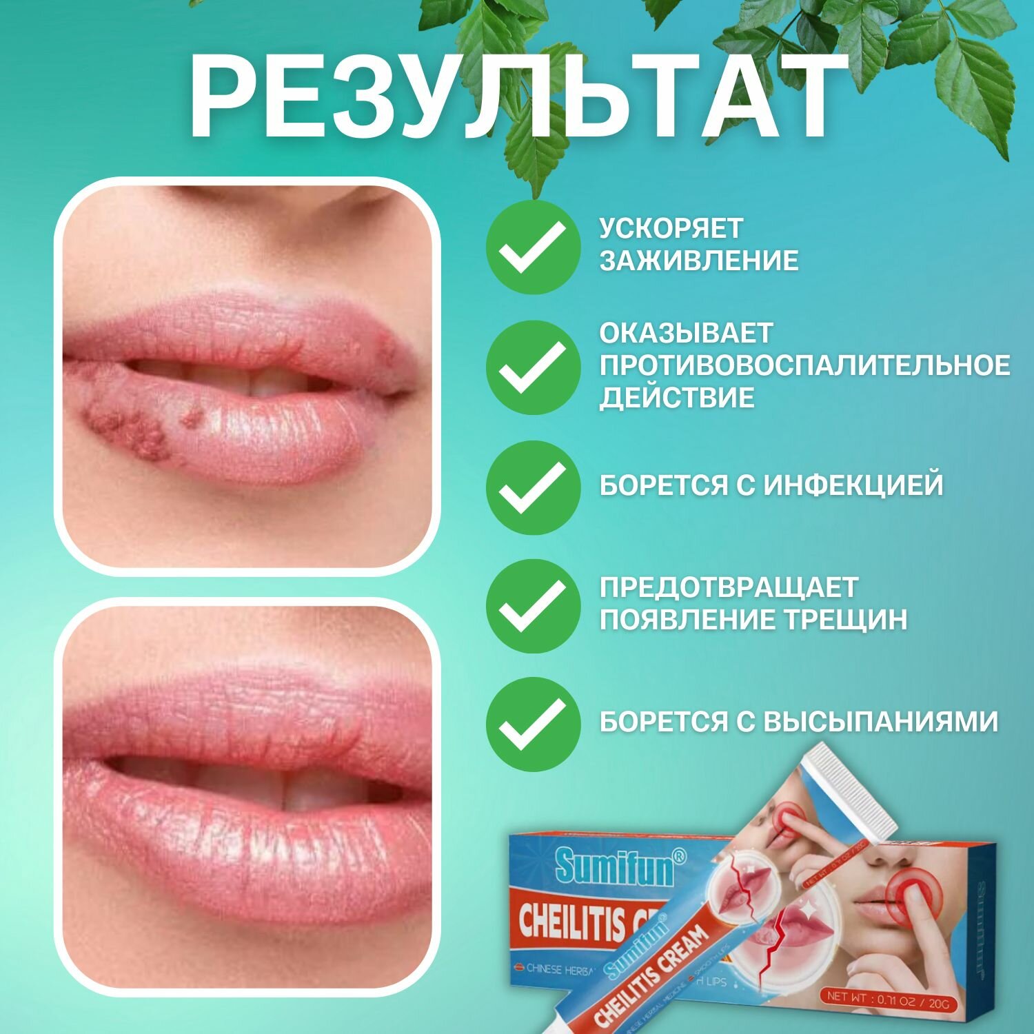 Картинки Крем от герпеса / хейлита губ / антибактериальная мазь от герпеса