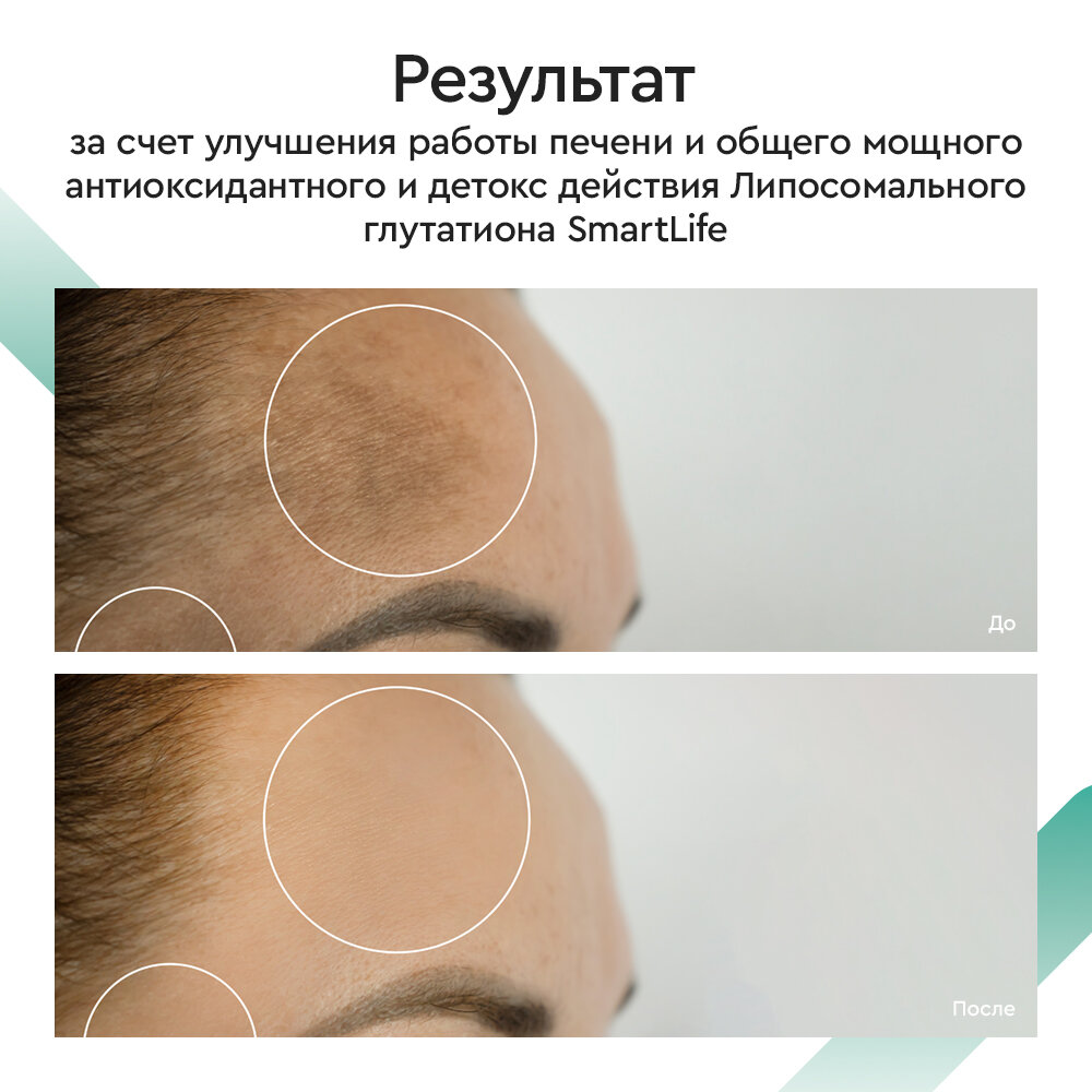 Глутатион липосомальный Smartlife/Смартлайф раствор для приема внутрь 100мл ООО СМАРТЛАЙФ - фото №8