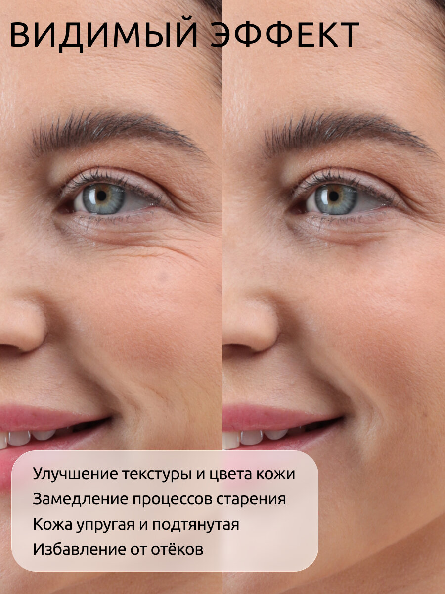 ReadySkin Care Lifting Gel/ Гель для лифтинга токопроводящий гель для микротоков и RF-лифтинга лица, 250 мл. — фото 1