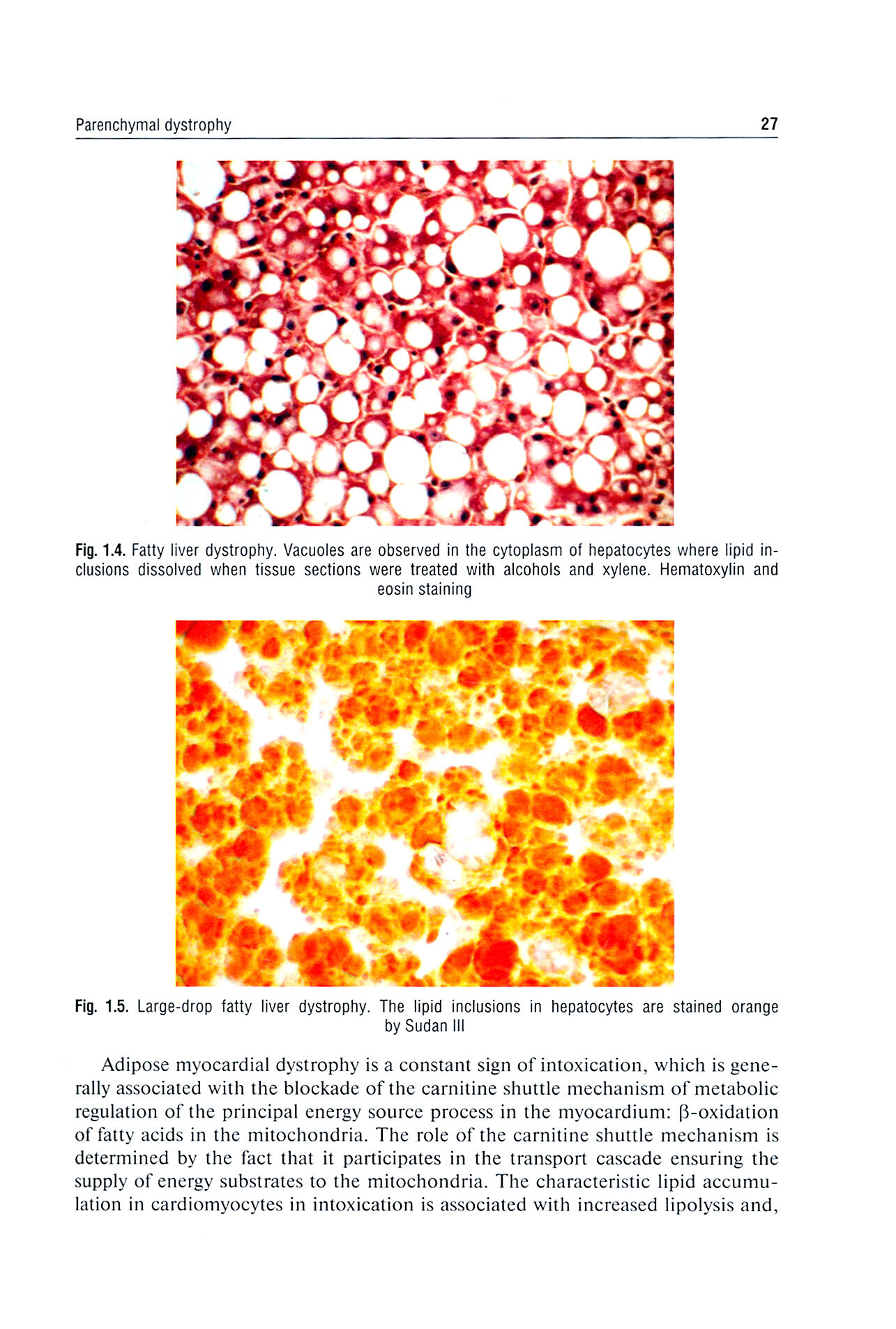 Pathological Anatomy. Textbook - фото №4