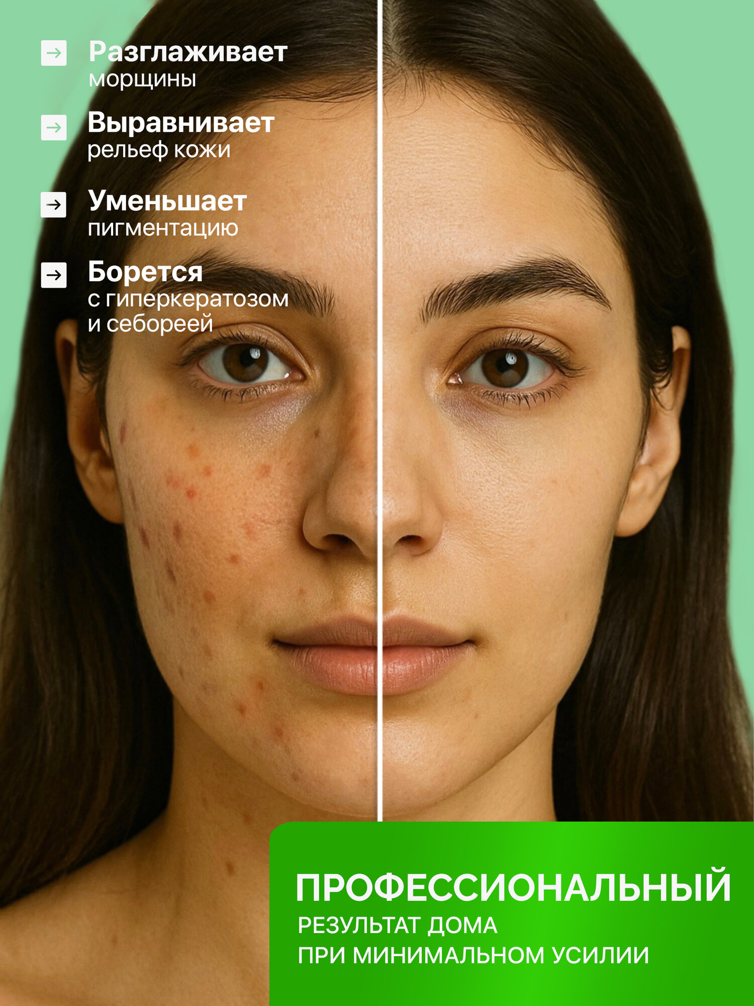 Изображение Миндальный пилинг для проблемной кожи VISELLE Mandelic Detox Peel 30% с комплексом DETOXONDRIA