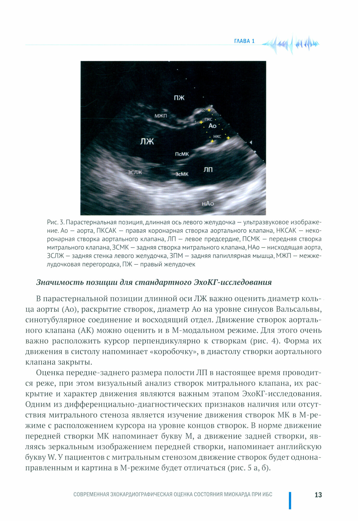 Современная эхокардиографическая оценка состояния миокарда при ИБС - фото №2